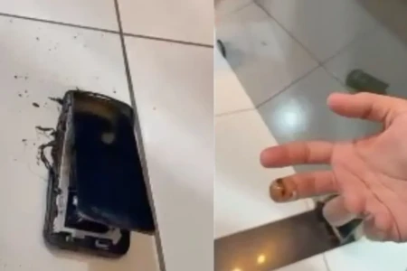 Murilo queimou a ponta dos dedos quando tirou o celular em chamas do sofá em Porangatu (Foto: Reprodução)