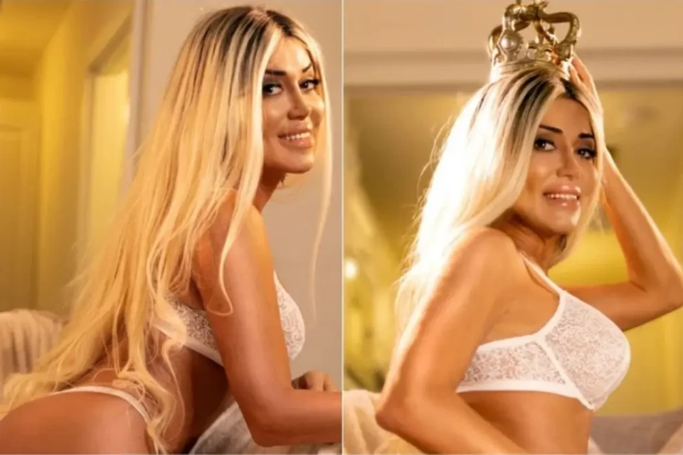 Mulher Abacaxi revela que gastou R$ 500 mil em transição de gênero e mostra foto do "antes"; veja fez as pazes com o espelho após cirurgias