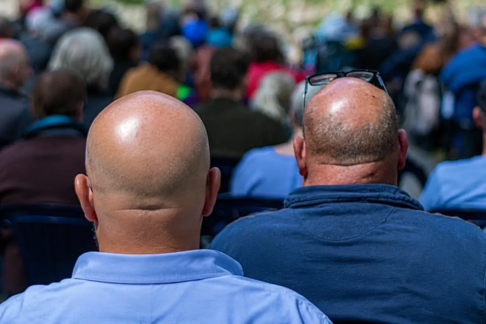 Queda de cabelo a substância que pode decretar o fim da calvície molécula promete estimular crescimento de fios onde não havia cabelo