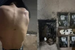 Vítima sofreu ferimentos por todo o corpo - (Foto: reprodução/PC)