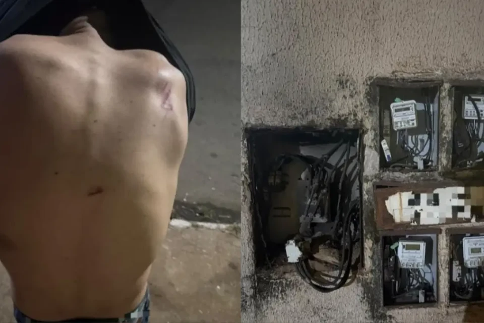 Vítima sofreu ferimentos por todo o corpo - (Foto: reprodução/PC)