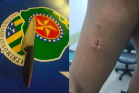 Faca usada no crime e braço do PM que foi mordido - (Foto: reprodução/PM)
