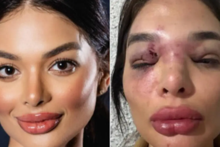 Dentista Giulia Melo Falcão, agredida por Vel Kos