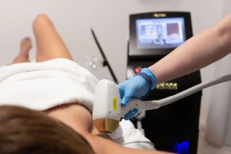 depilacao a laser