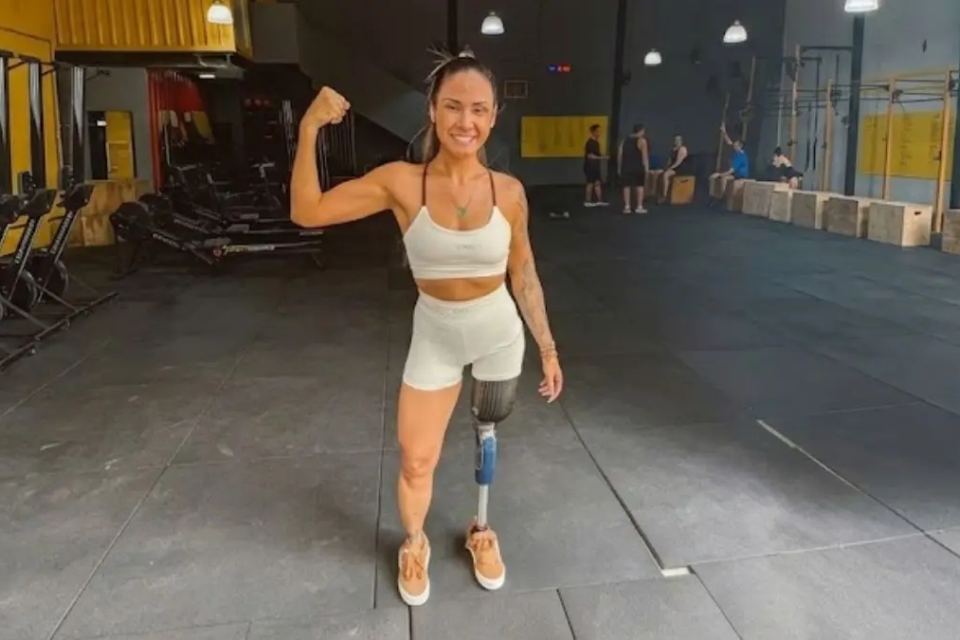 Letícia Silvério aparece em foto retratando sua trajetória após o câncer e a amputação na adolescência