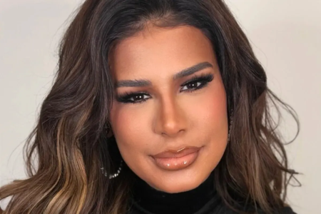 Simone Mendes responde críticas após mudança no nariz Cantora passou por uma rinomodelação com fios de sustentação